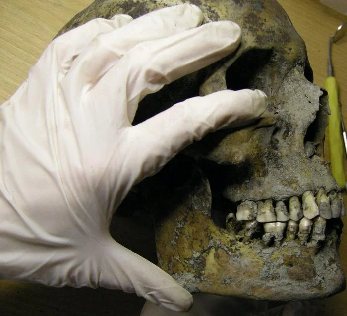 Gloved hands hold a skull during examination of the jaw and teeth in the Varnhem dental research project.